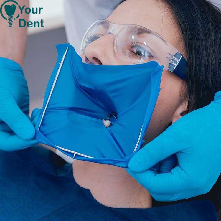 Dental Dam - סכר גומי 5*5 6*6 -