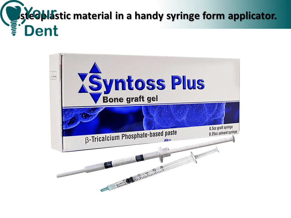 סינטוס פלוס - Syntoss Plus Osteoplastic Material In a Handy Syring