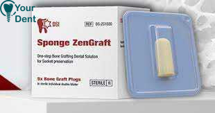 ספוגיות קולגן עם עצם לשמירת מכתשית - Sponge ZENGRAFT DS-ZG1020